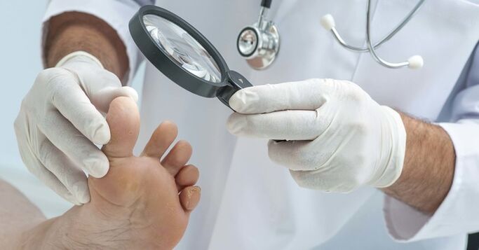 Диагностично изследване на ноктите на краката