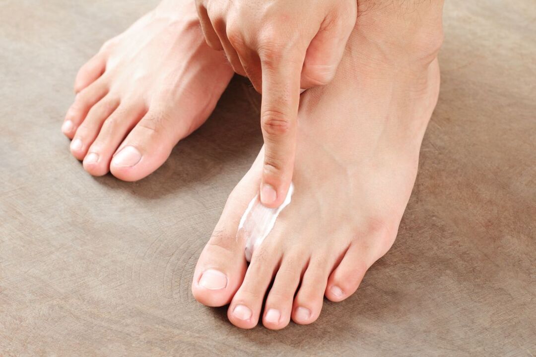 лечение на гъбички по краката с мехлем
