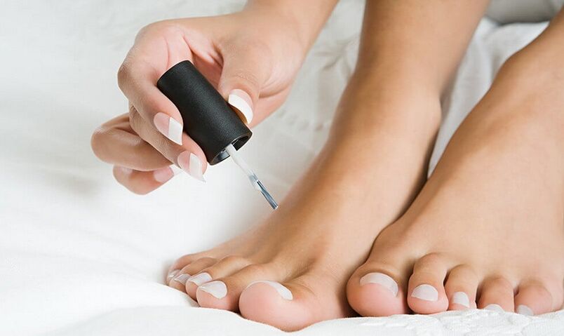 нанасяне на лак за лечение на гъбички по ноктите на краката